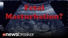 FETAL MASTURBATION: Anti-Abortion GOP Congressman Says Fetus Feels Pleasure